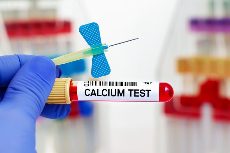 calcium test gujrat