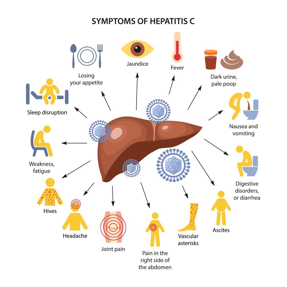 best-hcv-antibody-screening-ict-method-test-lab-gujrat-pakistan