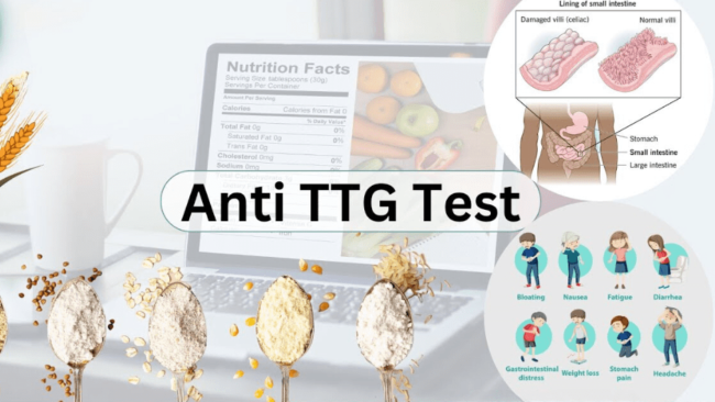 Anti Tissue Transglutaminase (TTG) IGG (CLIA) Test