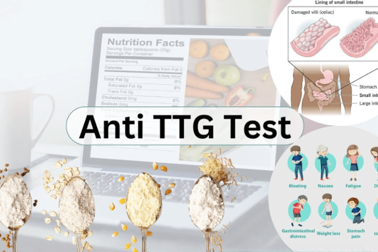 Anti Tissue Transglutaminase (TTG) IGG (CLIA) Test