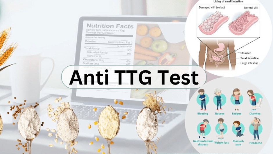 Accurate Anti Tissue Transglutaminase (TTG) IGG Test in Gujrat with ...