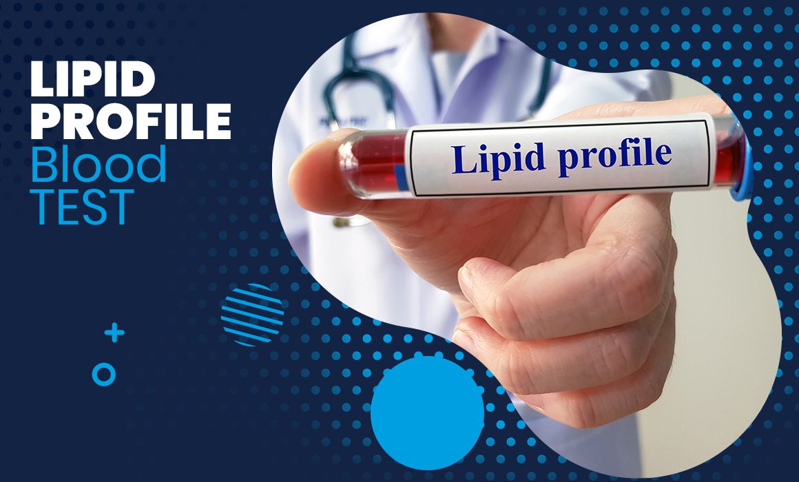 best-lipid-profile-test-lab-gujrat-pakistan-awami-lab